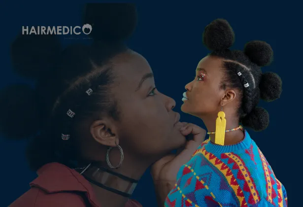 Afro Hair Transplant in Turkey