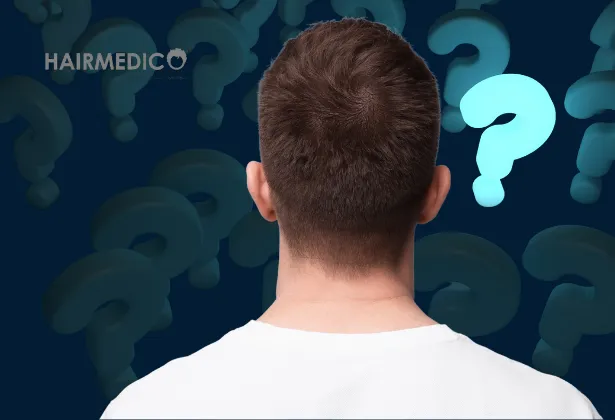 Donör Bölgeden Aşırı Saç Alımı: Saçlar Ekstraksiyon Sonrası Yeniden Çıkabilir mi?