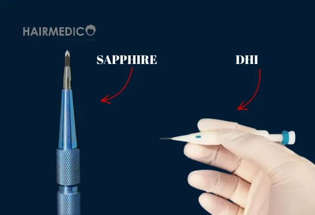 FUE vs DHI Hair Transplant in 2025: Key Differences and Best Technique for You