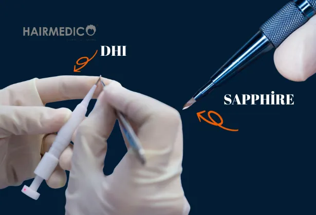 FUE mi yoksa DHI saç ekimi mi? 2025'te sizin için hangi teknik daha iyi?