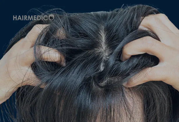 Saç Ekimi ve Cilt Tipi: Saç Derisi Sağlığı Sonuçları Nasıl Etkiler?