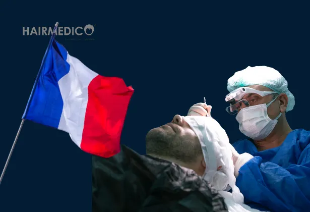 Hair Transplant in Marseille, France – Expert Care with Hairmedico and Dr. Arslan Musbeh