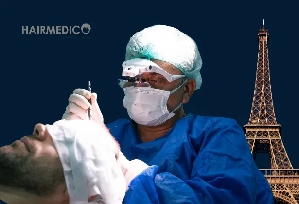 Hair Transplant Paris