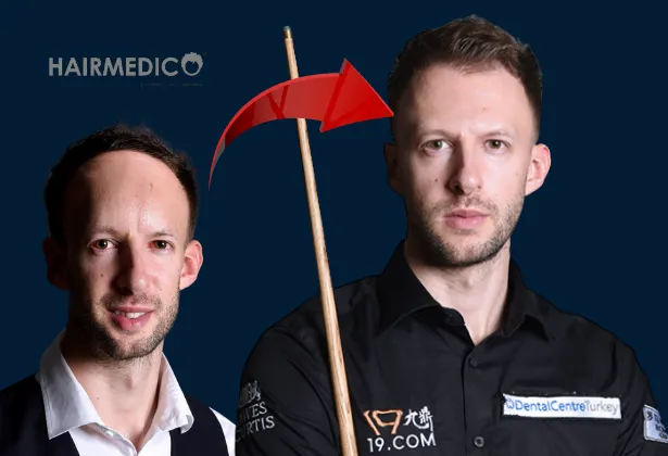 Snooker Yıldızı Judd Trump Saç Ekimi Yaptırdı mı?
