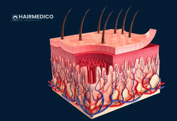 Microvascular Damage in Hair Transplant Surgery: What Clinic