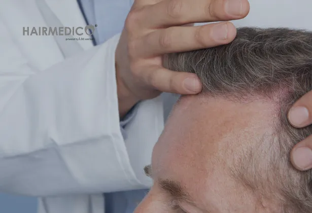 Türk FUE Saç Ekimi