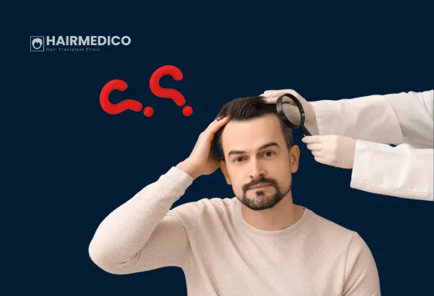 Bazı saç ekimlerinin 12 ay sonra bile neden "yapay" göründüğü