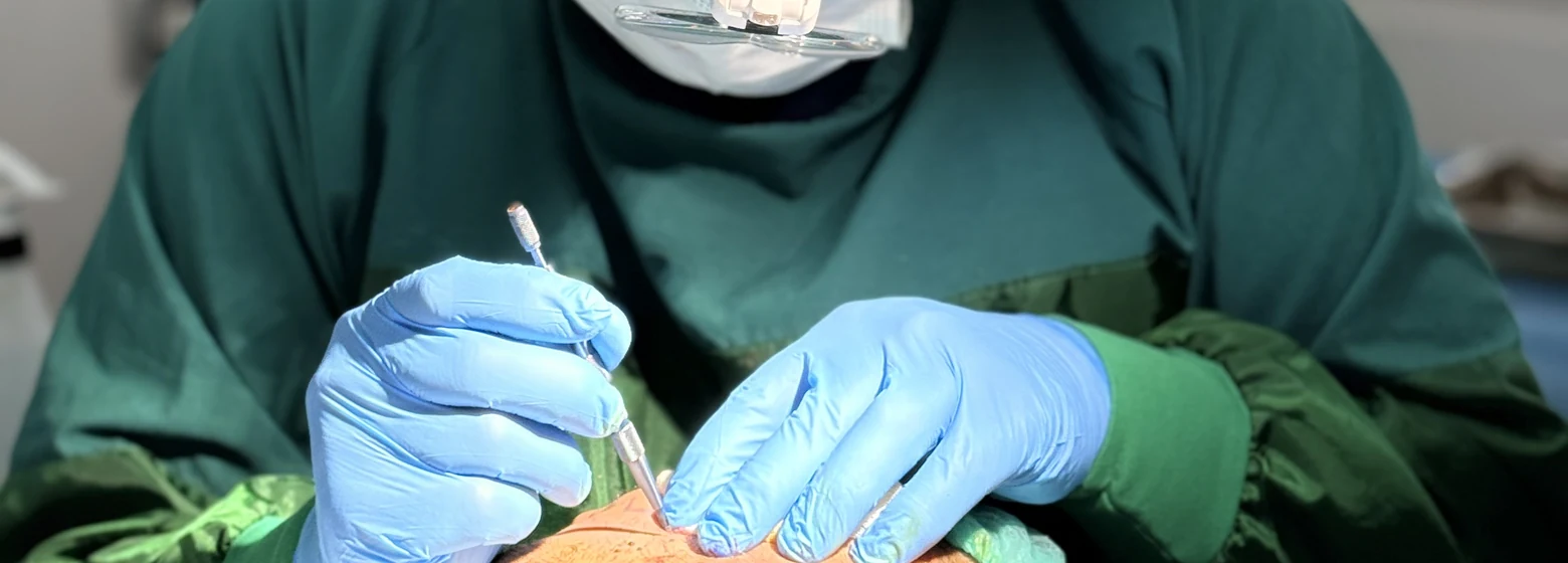 Hairmedico surgical team performing a Sapphire FUE hair transplant procedure in Istanbul