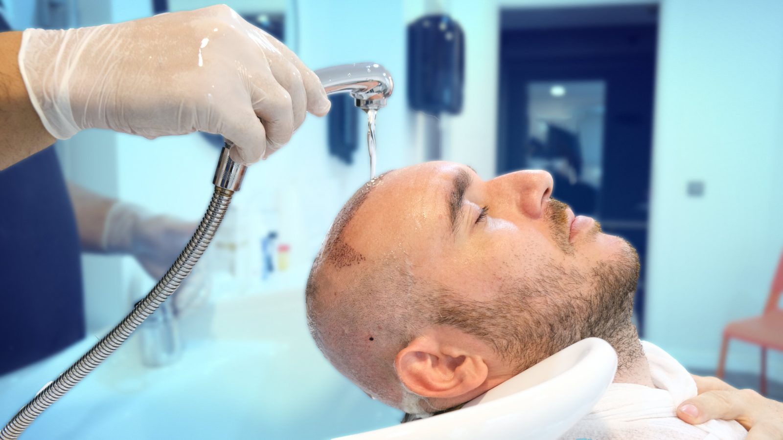 First Hair wash after hair transplant