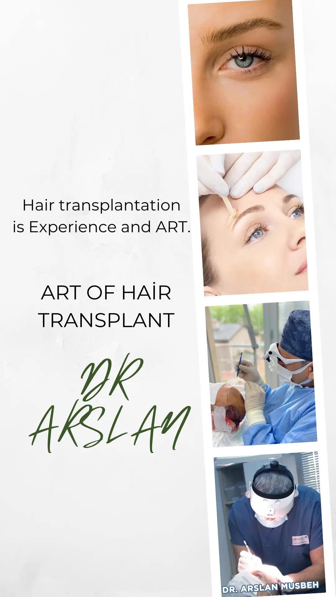 doctor arslan hair transplant surgeon